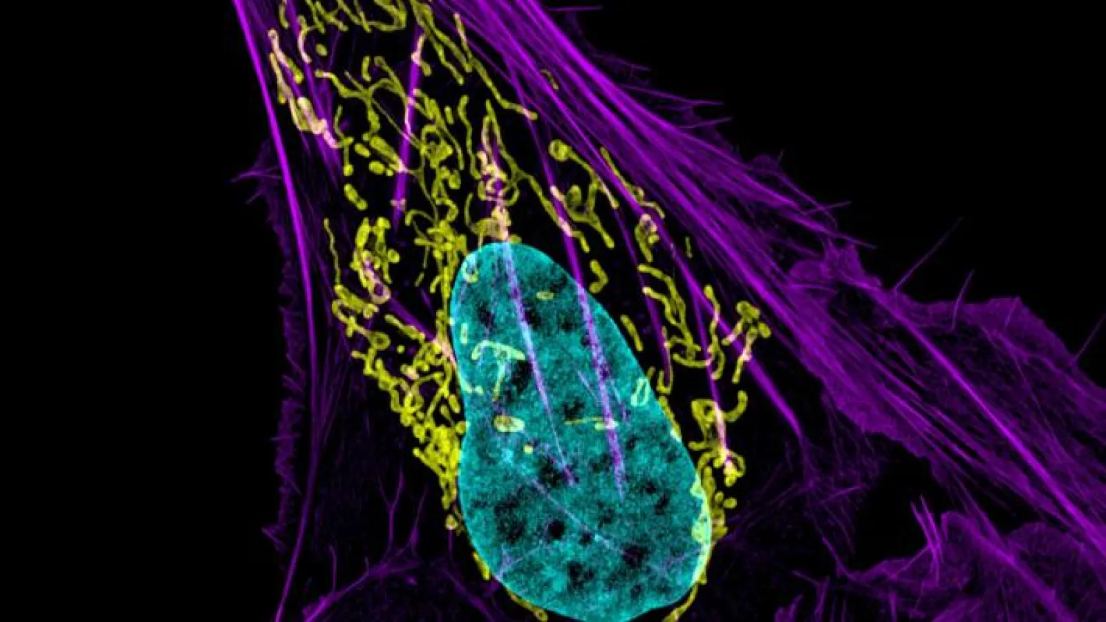 Mitochondria in an osteocarcinoma cell
