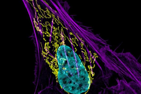 Mitochondria in an osteocarcinoma cell